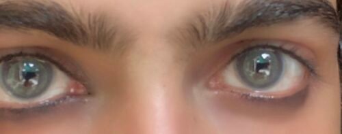 Dahab Color Lenses with free Solution kit photo review